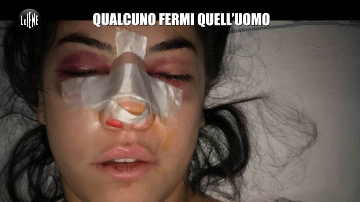 Chiara, l'ennesima vittima di violenze (Fonte Mediaset)