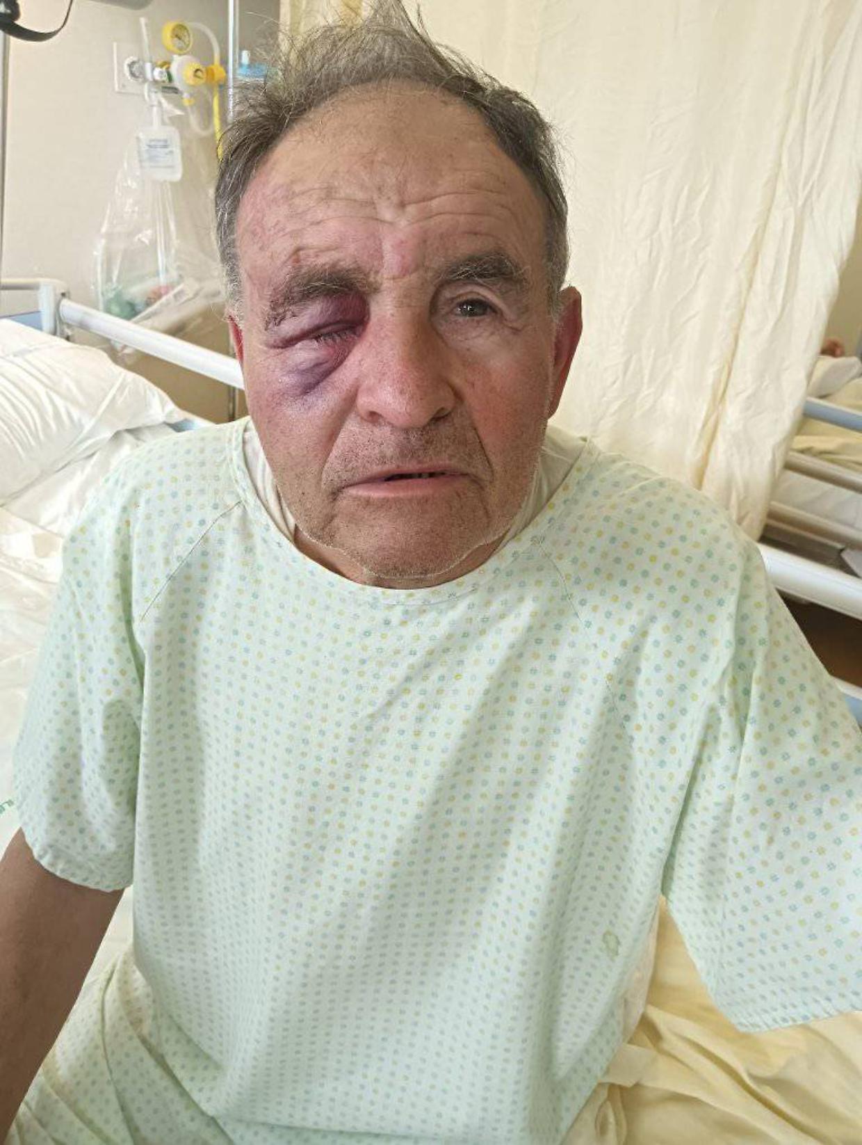 Ottantenne aggredito dall'inquilino moroso: un paese sotto shock