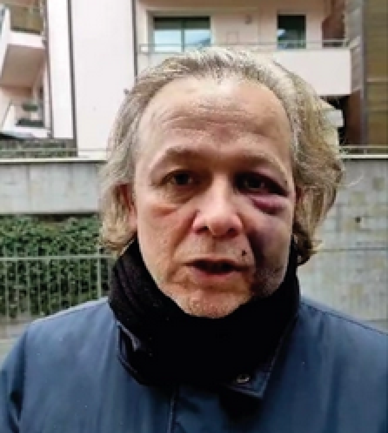 Aggressione a San Mamolo: la polizia analizza video e testimonianze per identificare i responsabili