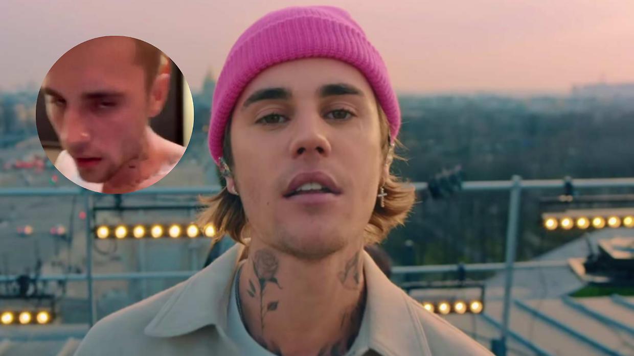 Il dramma di Justin Bieber: la popstar lotta per la salute mentale e la stabilità familiare