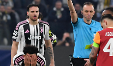 Juve fuori dalla Champions, ma cos&igrave; fa male