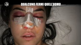 "Ti picchia perchè ti vuole bene": la straziante storia di Chiara alle Iene