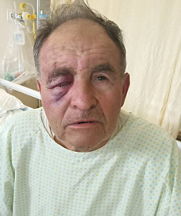 Ottantenne aggredito dall'inquilino moroso: "Poi è andato al ristorante come se nulla fosse"