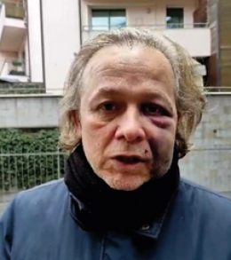 Aggressione a San Mamolo: la polizia analizza video e testimonianze per identificare i responsabili