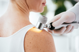 Dermatite atopica: visite gratuite in Emilia-Romagna, scopri tutti i dettagli
