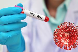 Hiv, l’allarme dell’Onu: senza fondi internazionali, entro il 2030 fino a 2,9 milioni di morti